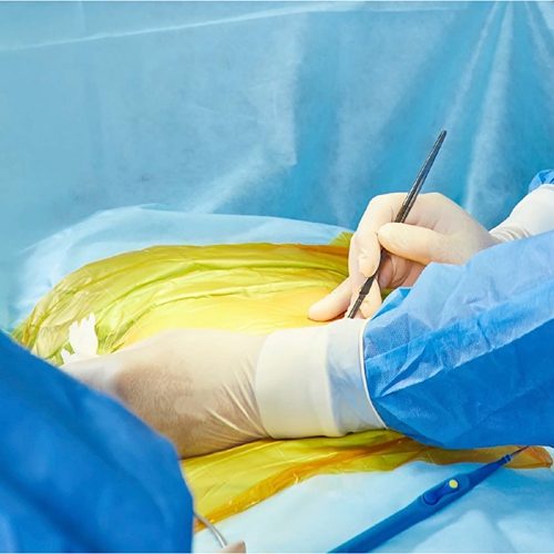 Surgical Incise Drape